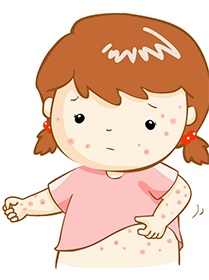 夏季孩子皮膚奇癢 是濕疹嗎？